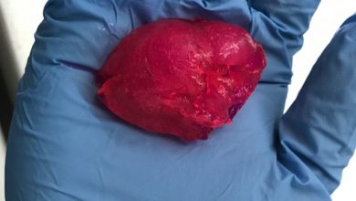 BIOLIFE4D 3D vytlacene srdce