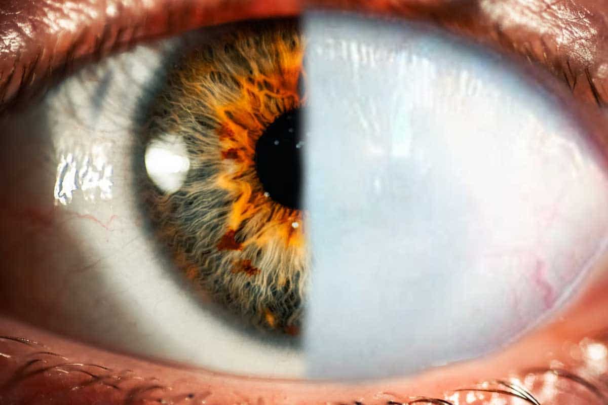 Vedcom sa podarilo oživiť neuróny v ľudskom oku